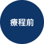 癌症患者於不同階段除了積極補充富含3效營養素的營養來源外，應選擇什麼樣的食物，並養成怎樣的飲食習慣？